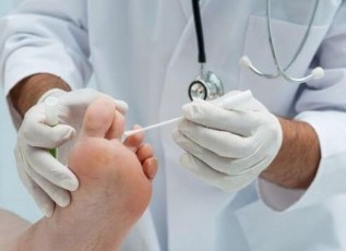 Chẩn đoán của nấm